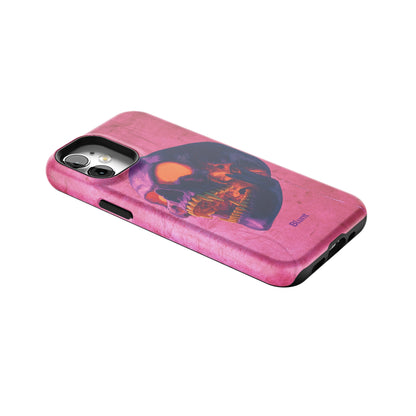 Neon Bite iPhone Case gallery - Iphone_12_Mini_Air_Plus_2