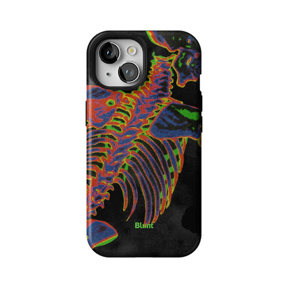 Toxic Ribs iPhone Case gallery - Iphone_15_Iphone_1