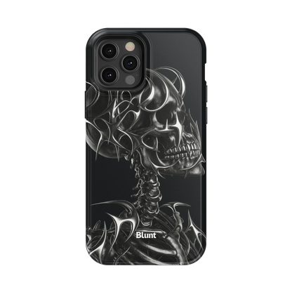 X-Ray iPhone Case
