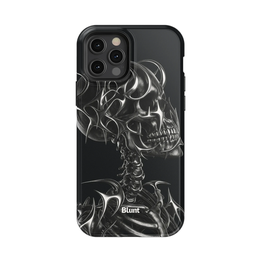 X-Ray iPhone Case