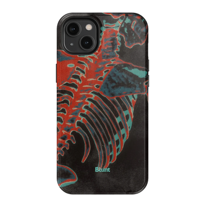 Bone Shredder iPhone Case