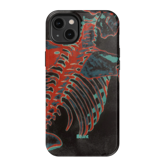Bone Shredder iPhone Case
