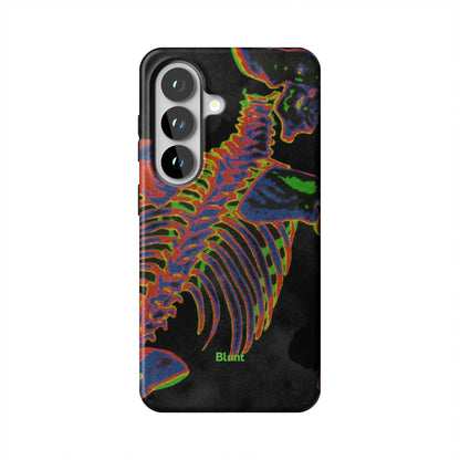 Toxic Ribs Samsung Case