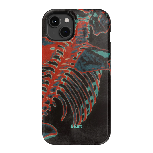 Bone Shredder iPhone Case