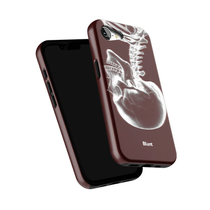 Crimson-Cranium-iphone-case-iPhone 17 E-5