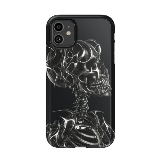X-Ray iPhone Case