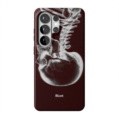 Crimson Cranium Samsung Case