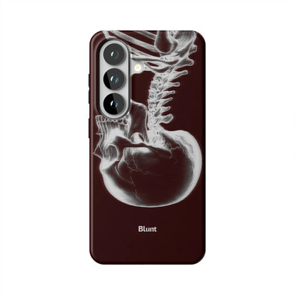 Crimson-Cranium-samsung-case-Galaxy S26-1