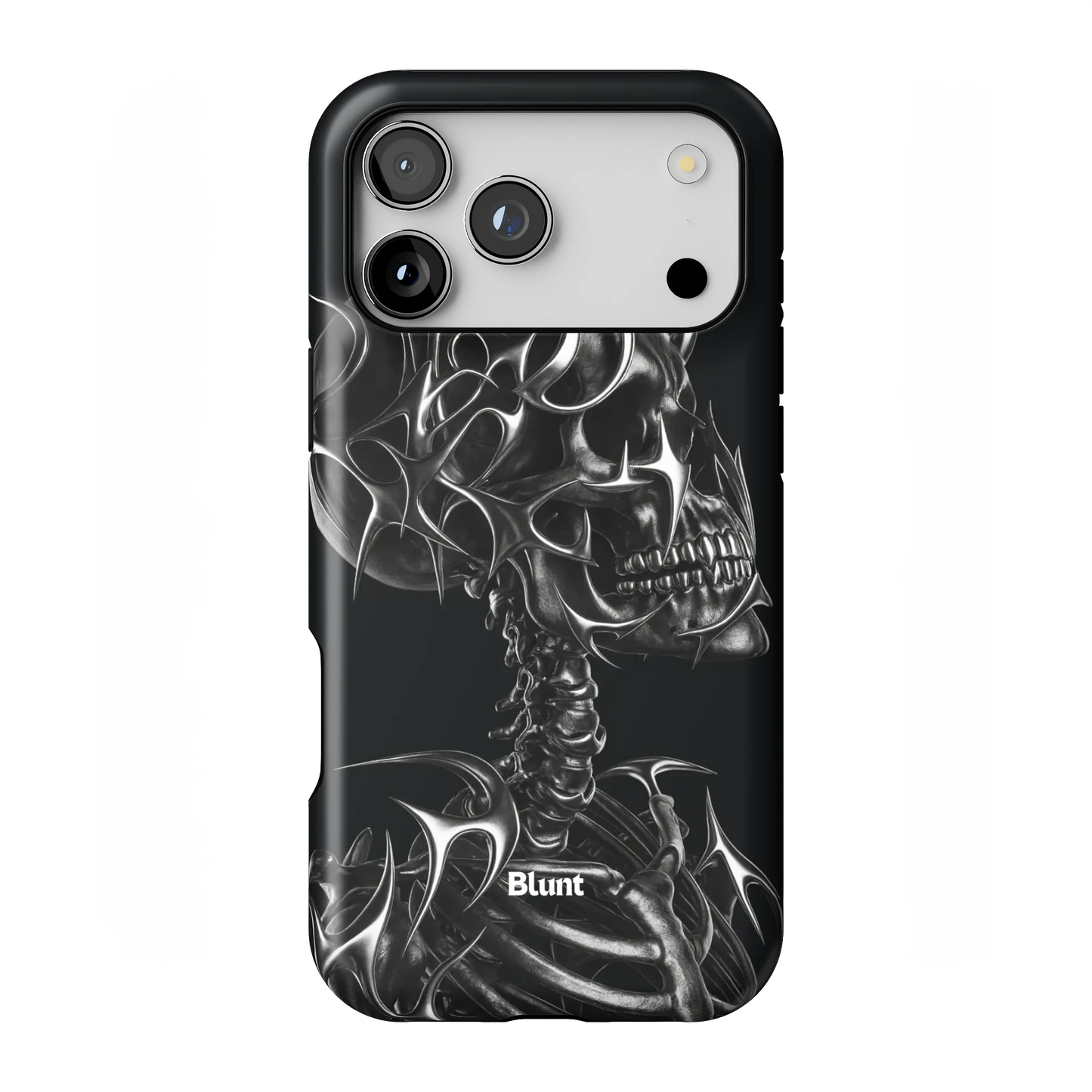 X-Ray iPhone Case