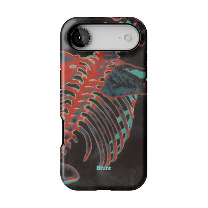 Bone Shredder iPhone Case