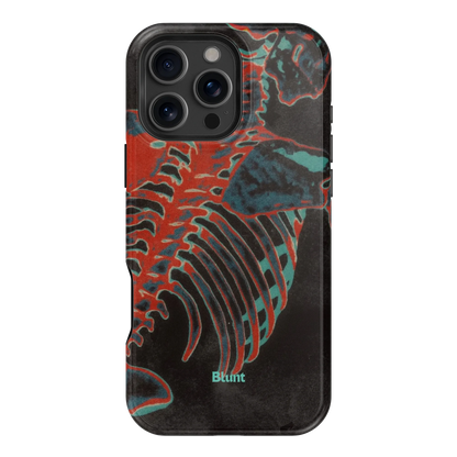 Bone Shredder iPhone Case