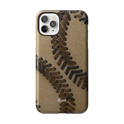 Saddle Braid iPhone Case gallery - Iphone_11_Pro_Max_1