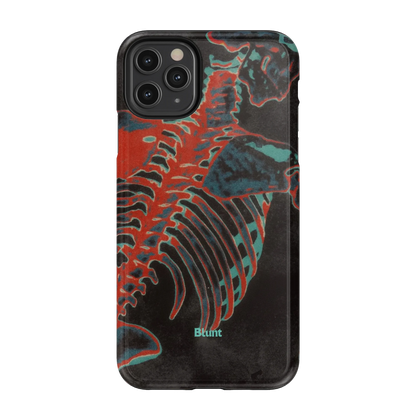 Bone Shredder iPhone Case