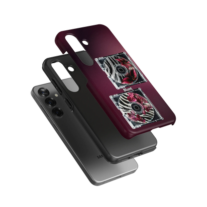 Zebra Mix Samsung Case