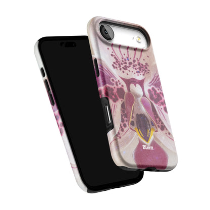 Solenne iPhone Case gallery - Iphone_17_Air_6