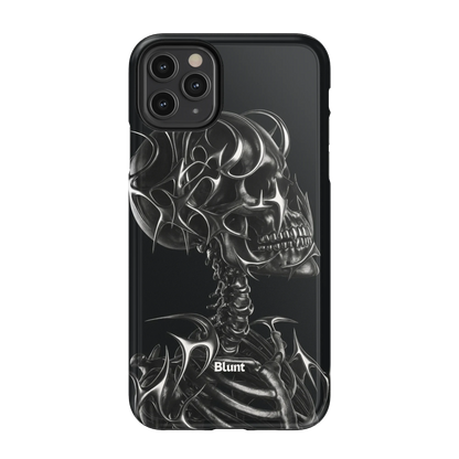 X-Ray iPhone Case