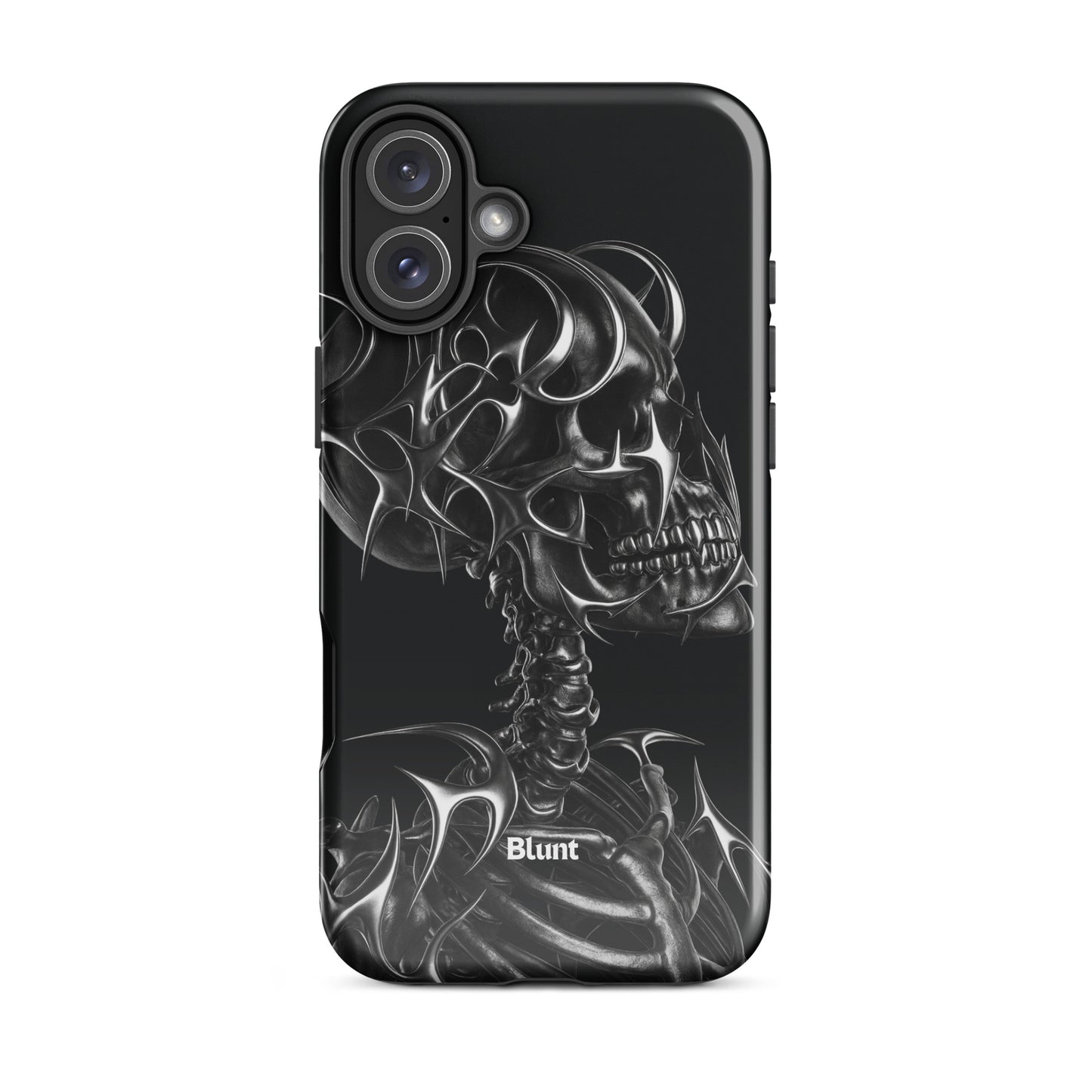 X-Ray iPhone Case