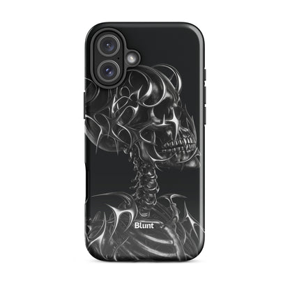 X-Ray iPhone Case