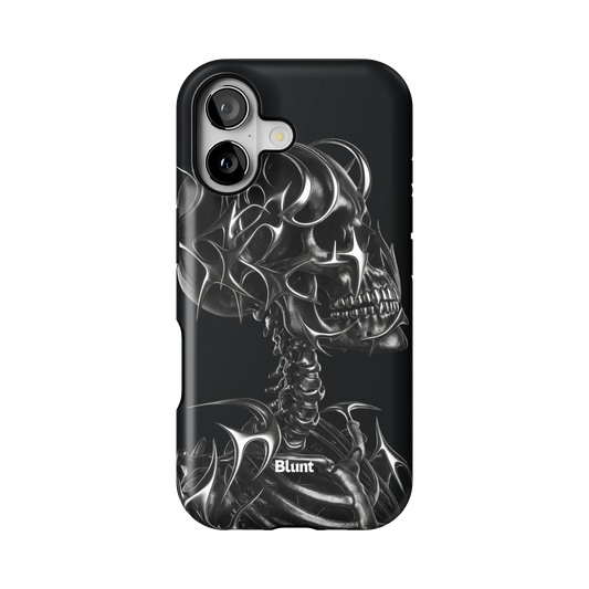 X-Ray iPhone Case