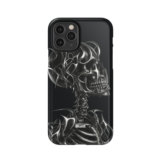 X-Ray iPhone Case
