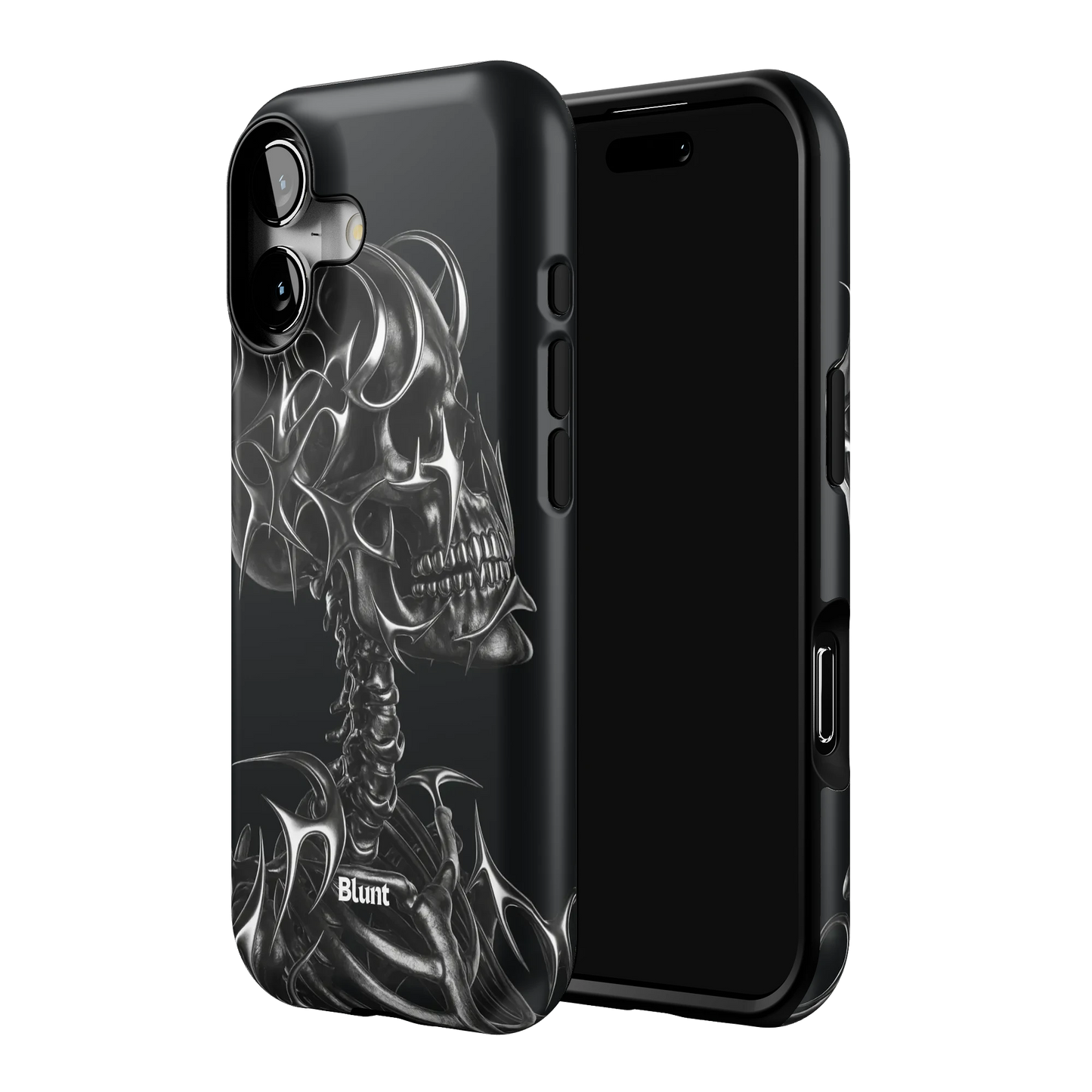 X-Ray iPhone Case
