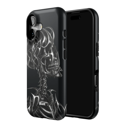 X-Ray iPhone Case