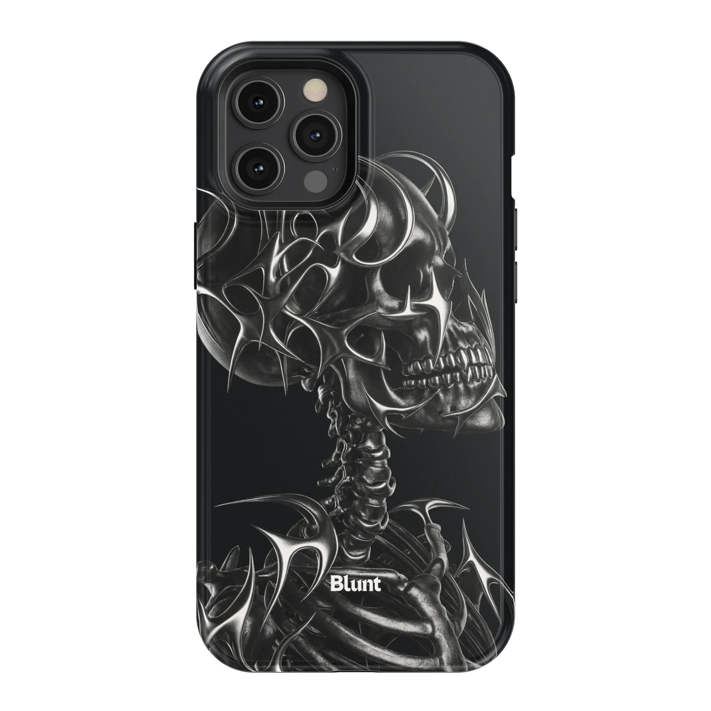X-Ray iPhone Case