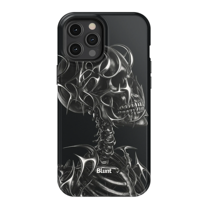X-Ray iPhone Case