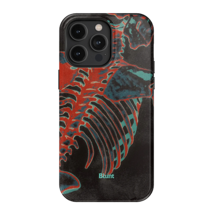 Bone Shredder iPhone Case
