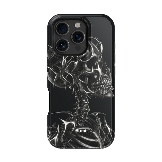 X-Ray iPhone Case