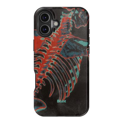 Bone Shredder iPhone Case